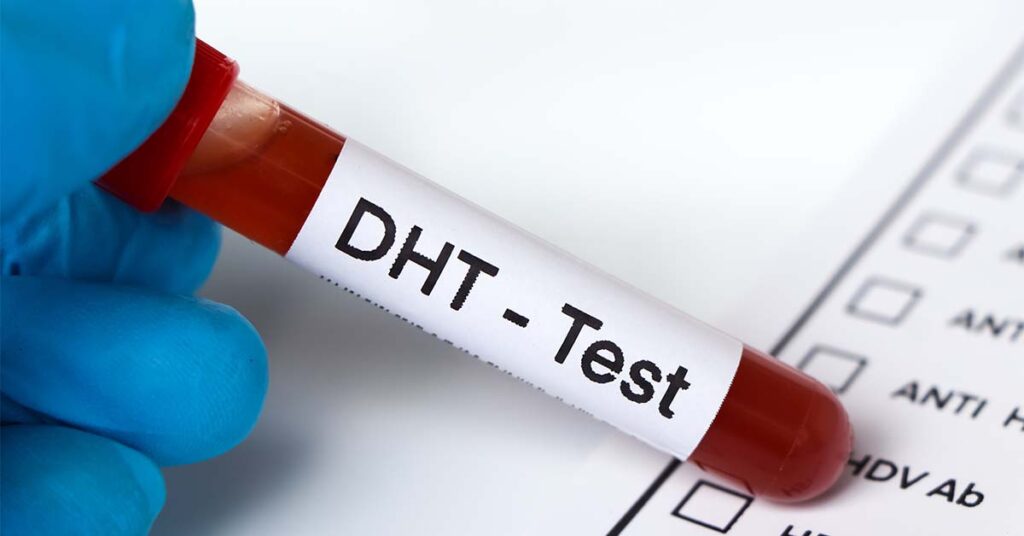 DHT test vial
