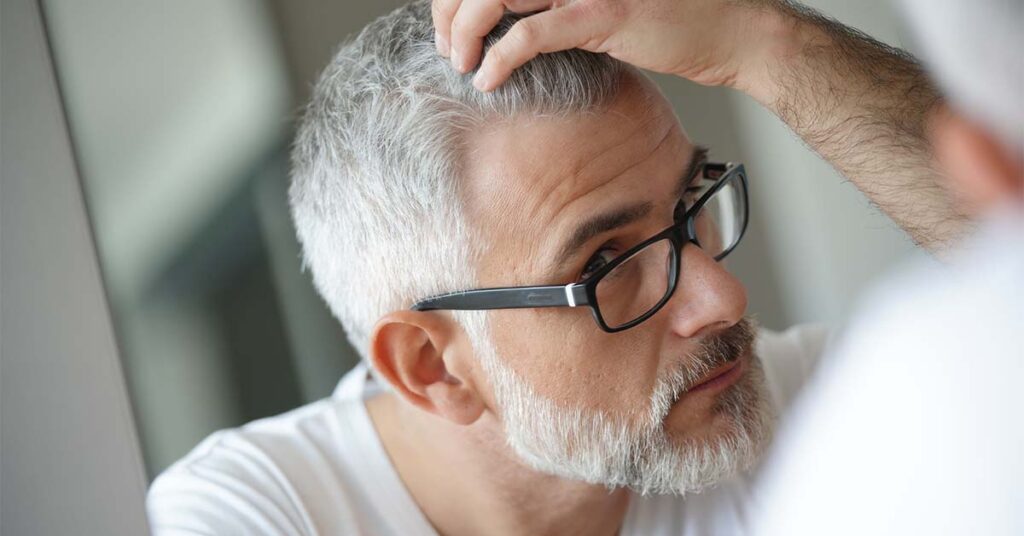 Aging, graying, and balding.