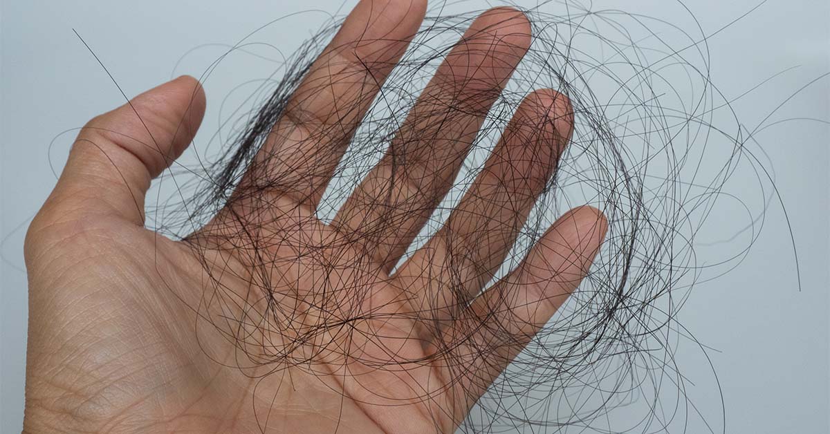 Clump of hair in hand.