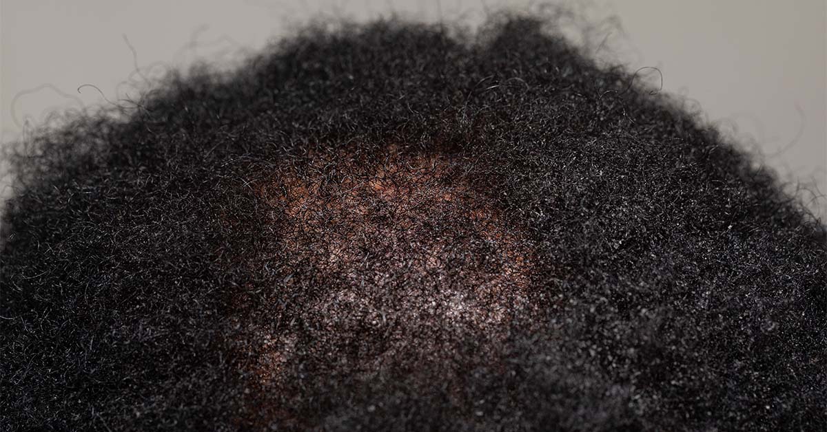afro-textured hair