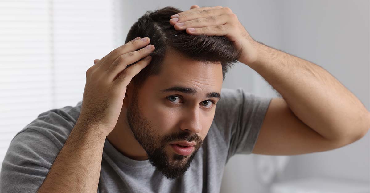 Man checking hair loss along the part in his hair.