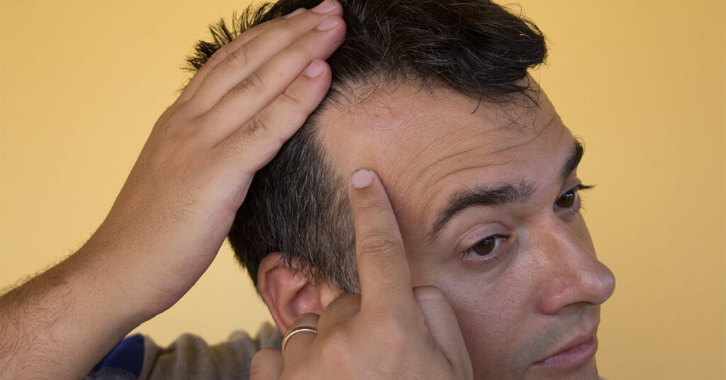 Man checking out receding hairline.
