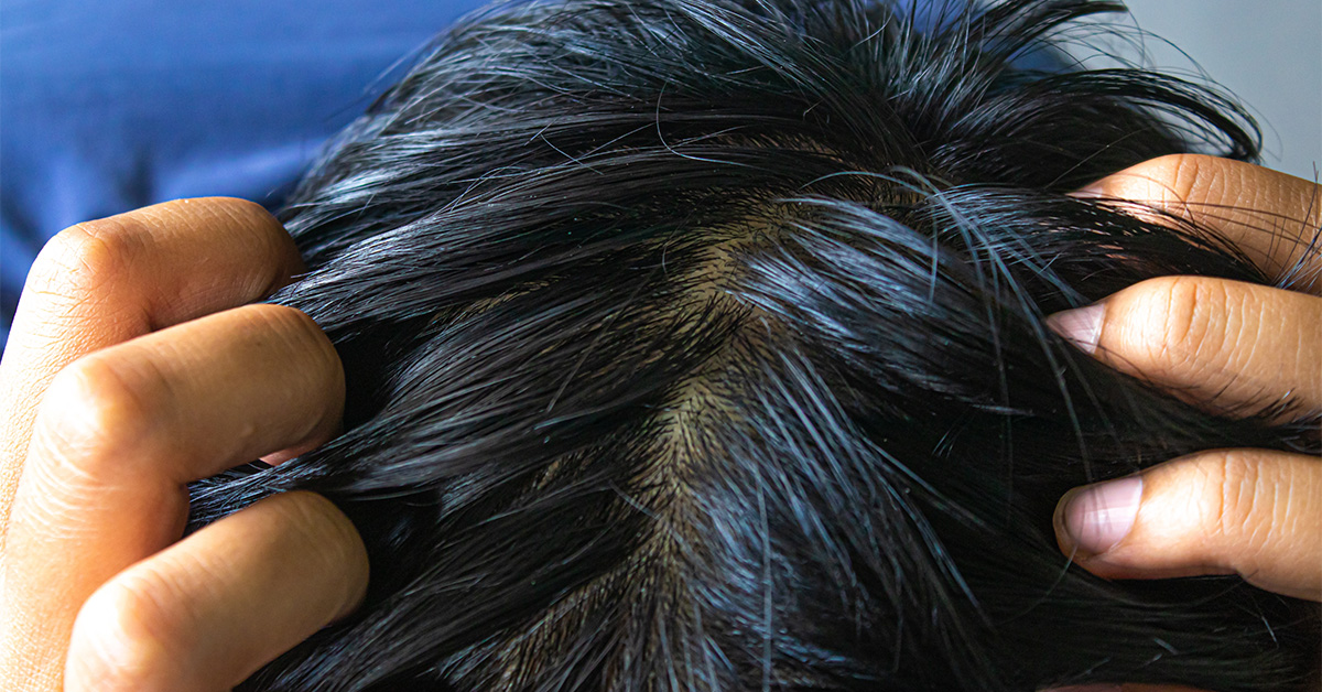 Checking for a widening part.