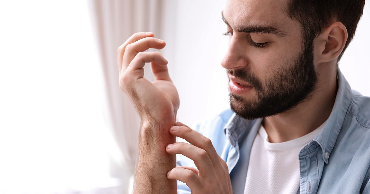 Man concerned about dry, flaky skin