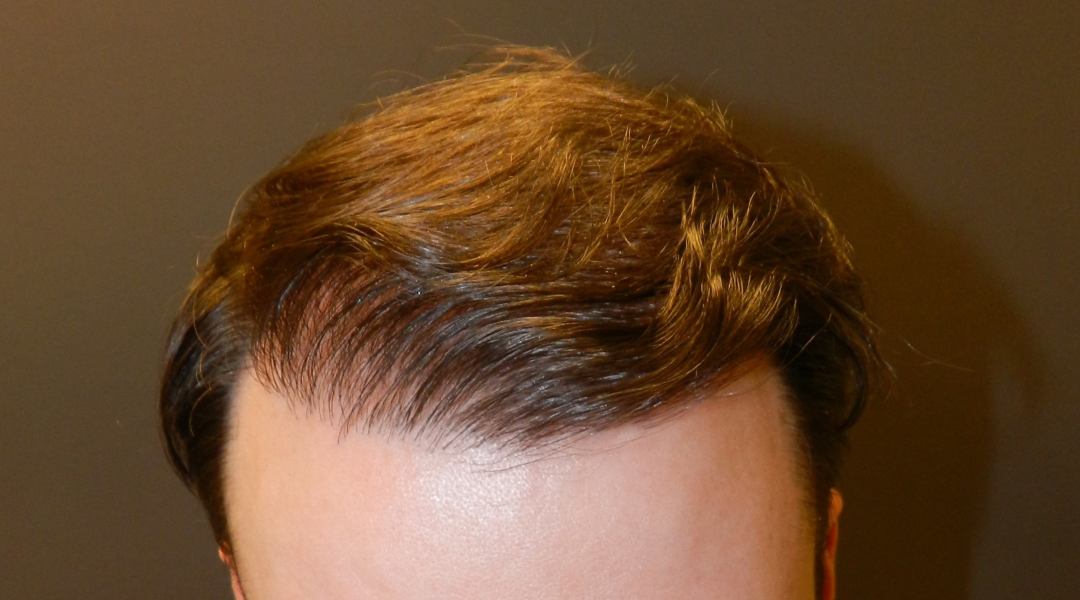 9ad0c6e33fb2de05220fd17238258df158cabcf5