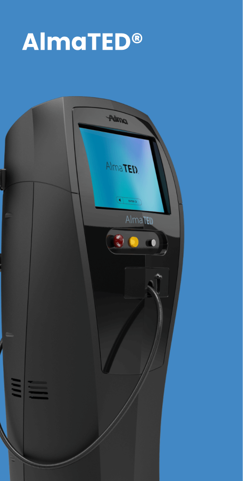 Alma TED hair growth treatment