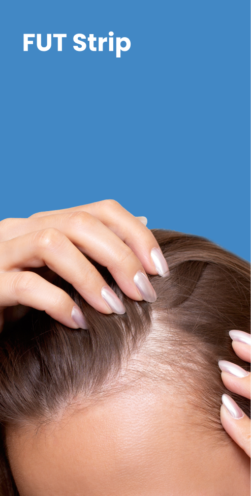 Close-up of hairline with hands