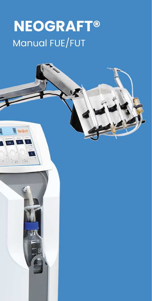 NeoGraft hair restoration procedure